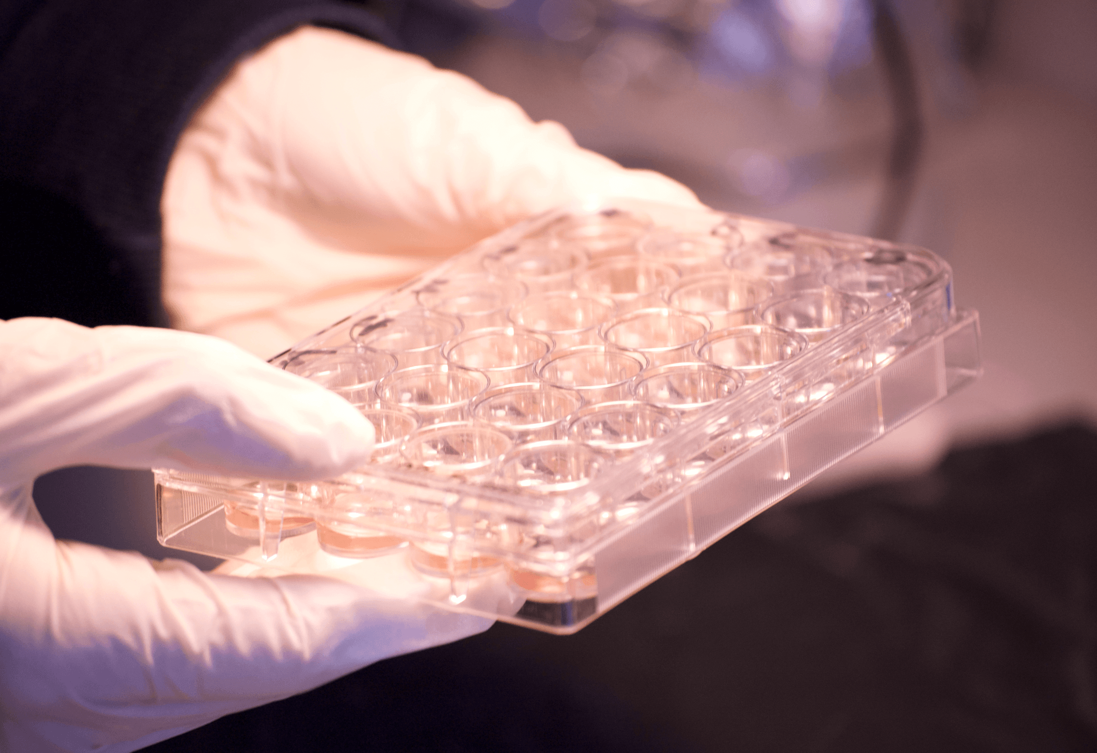 Petri dish cultures