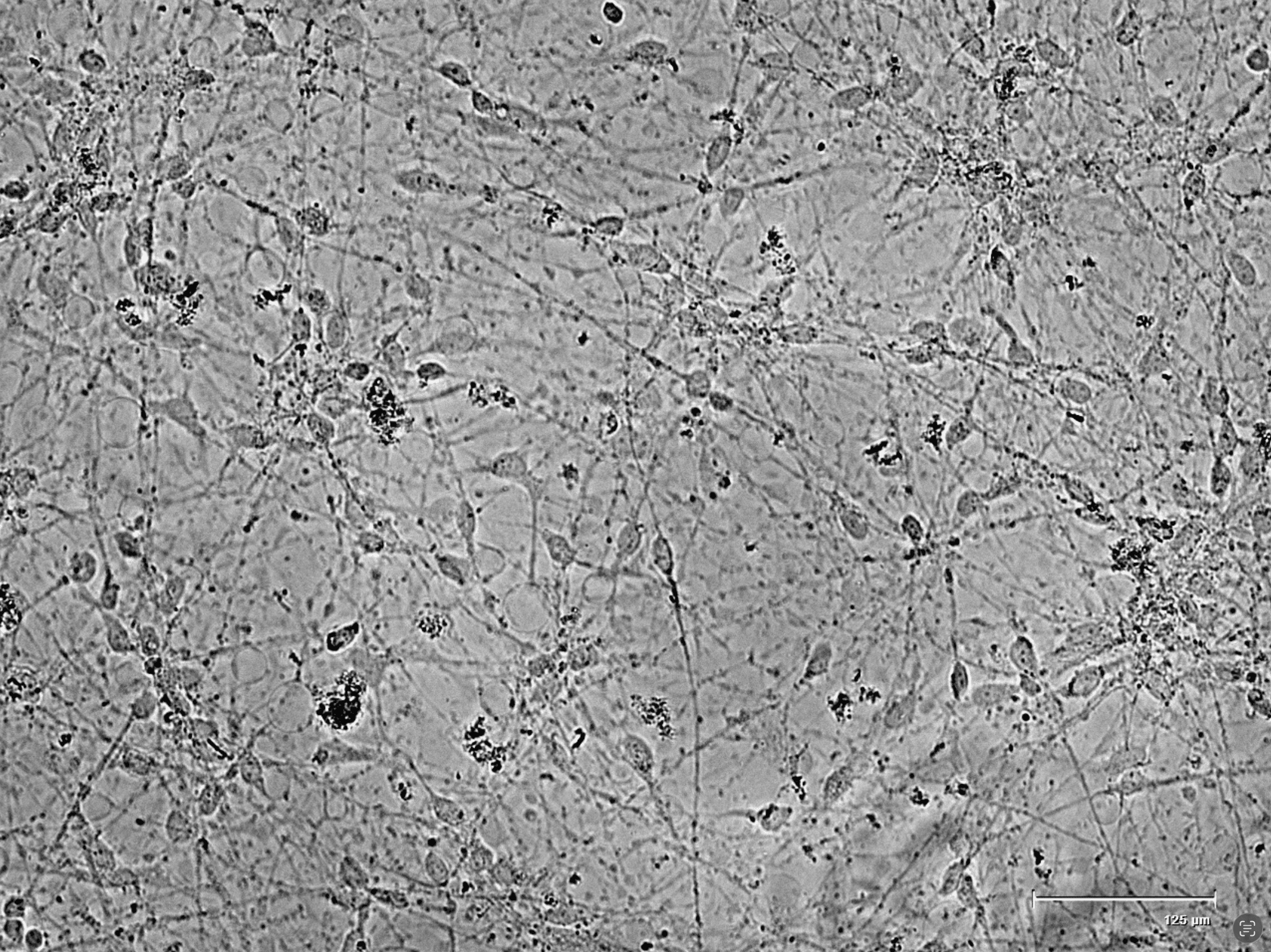 Neurons under a microscope
